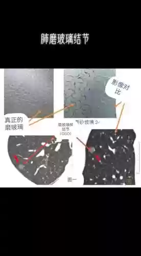 ct阵容英文_1插图1